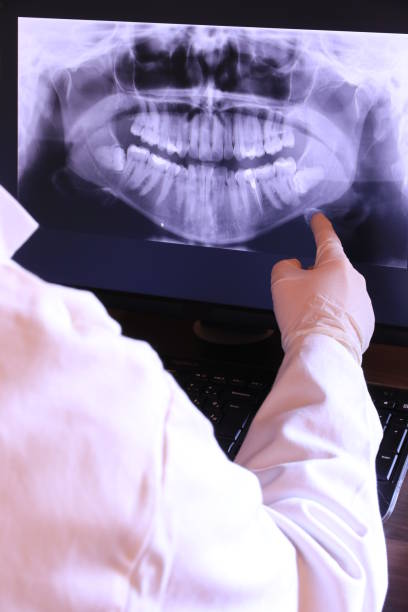 Best Emergency Root Canal Treatment in Hampton, VA